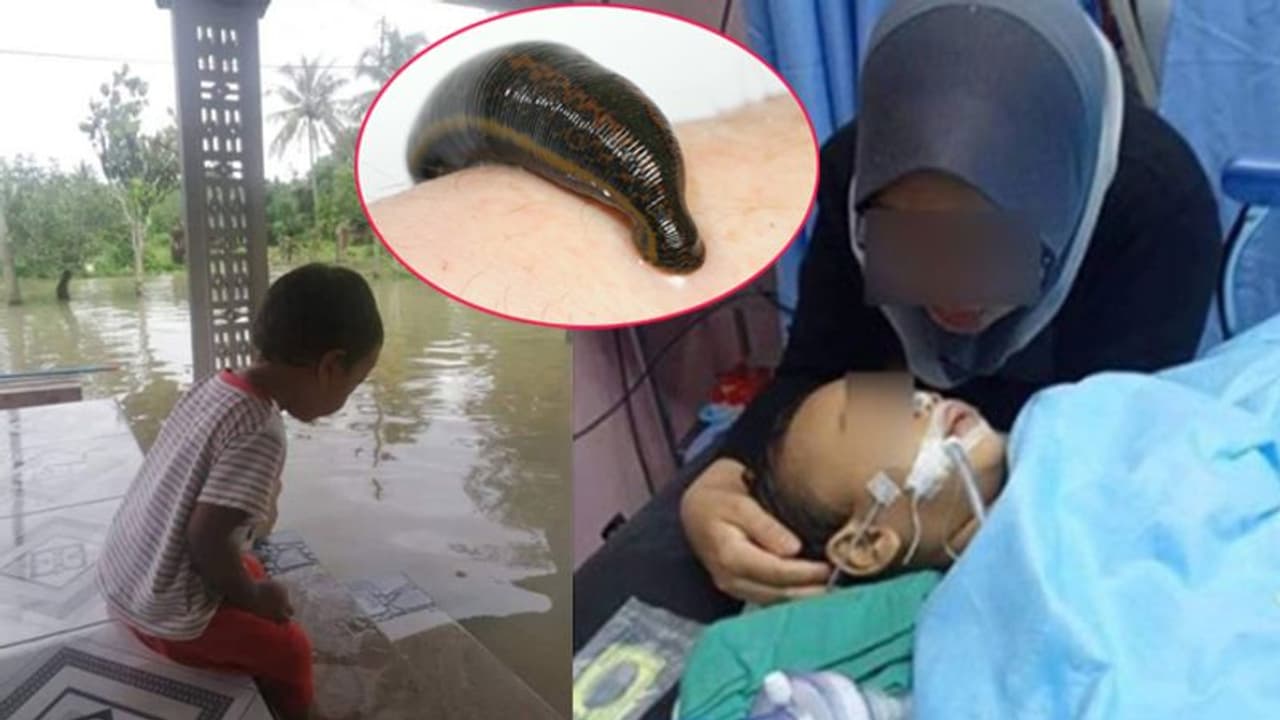 बाढ़ के पानी में मस्ती कर रहा बच्चा अचानक करने लगा खून की उल्टियां, पहुंच गया कोमा में बाढ़ के पानी में मस्ती कर रहा बच्चा अचानक करने लगा खून की उल्टियां, पहुंच गया कोमा में