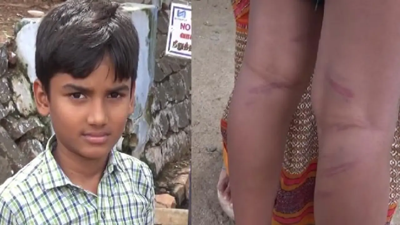 வகுப்பறையில் பேசிய மாணவனை பிரம்பால் வெளுத்த ஆசிரியர்..! ரத்த தழும்புகளுடன் மருத்துவமனையில் அனுமதி..! வகுப்பறையில் பேசிய மாணவனை பிரம்பால் வெளுத்த ஆசிரியர்..! ரத்த தழும்புகளுடன் மருத்துவமனையில் அனுமதி..!