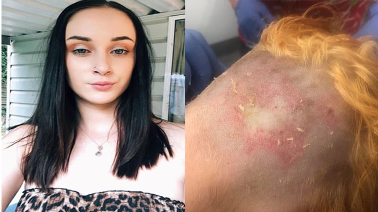 काले बालों को सुनहरा करना चाहती थी लड़की, फैशन के चक्कर में हुआ खौफनाक हाल काले बालों को सुनहरा करना चाहती थी लड़की, फैशन के चक्कर में हुआ खौफनाक हाल