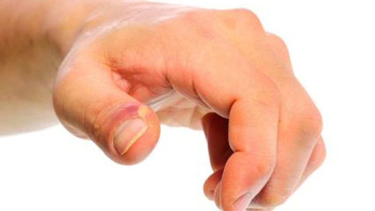 കുഴിനഖം മാറാൻ വീട്ടിലുണ്ട് ചില മാർഗങ്ങൾ കുഴിനഖം മാറാൻ വീട്ടിലുണ്ട് ചില മാർഗങ്ങൾ