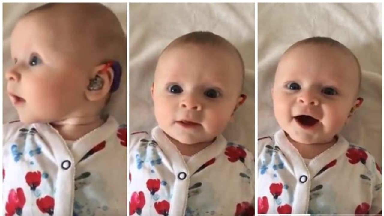 ''ആദ്യമായി ശബ്ദം കേട്ടപ്പോഴുള്ള അവളുടെ ചിരി...'' വൈറലായി വീഡിയോ ''ആദ്യമായി ശബ്ദം കേട്ടപ്പോഴുള്ള അവളുടെ ചിരി...'' വൈറലായി വീഡിയോ