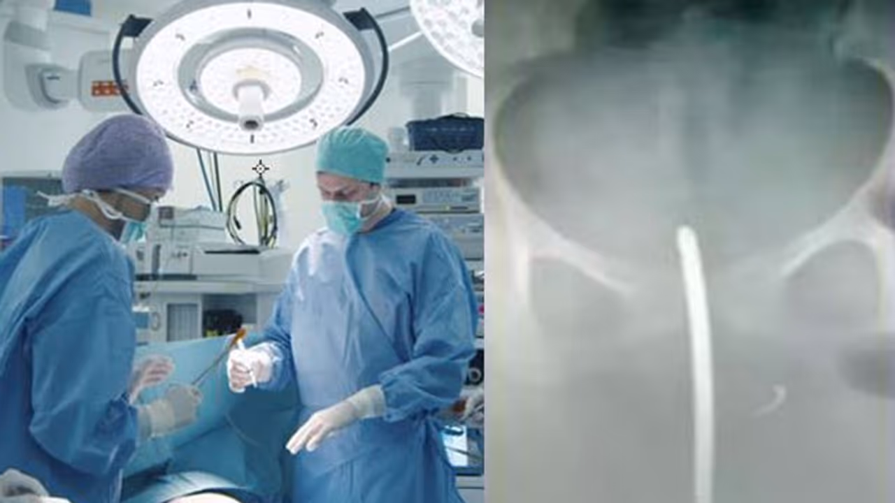 പ്രസവം കഴിഞ്ഞപ്പോൾ അമിത രക്തസ്രാവവും ശക്തമായ വയറ് വേദനയും അനുഭവപ്പെട്ടു ; എക്‌സ് റേ പരിശോധനാ ഫലം കണ്ടപ്പോൾ ഡോക്ടർമാർ ഞെട്ടി