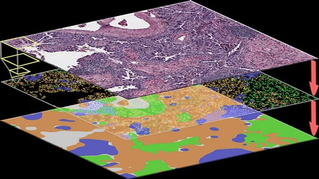 Research : अब आर्टिफिशियल इंटेलिजेंस के जरिए कैंसर सेल्स की पहचान होगी संभव Research : अब आर्टिफिशियल इंटेलिजेंस के जरिए कैंसर सेल्स की पहचान होगी संभव