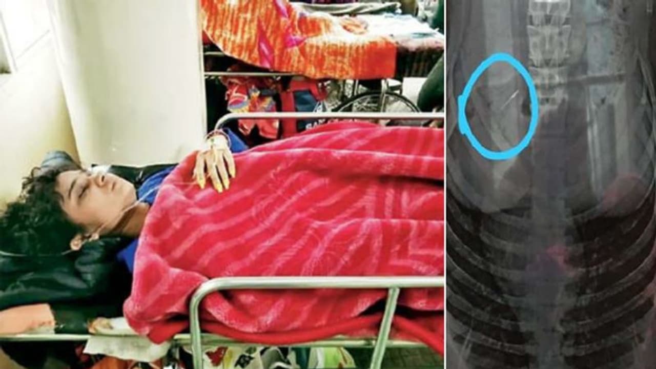 दांतों का ट्रीटमेंट करते वक्त डेंटिस्ट ने कर दी इतनी बड़ी गलती कि आफत में फंसी बच्ची की जान दांतों का ट्रीटमेंट करते वक्त डेंटिस्ट ने कर दी इतनी बड़ी गलती कि आफत में फंसी बच्ची की जान