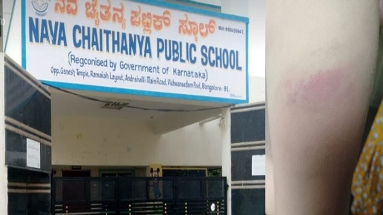 ಬೆಂಗಳೂರು: ವೈಯಕ್ತಿಕ ಕಾರಣಕ್ಕೆ 1ನೇ ಕ್ಲಾಸ್ ವಿದ್ಯಾರ್ಥಿನಿ ಥಳಿಸಿದ ಶಿಕ್ಷಕಿ