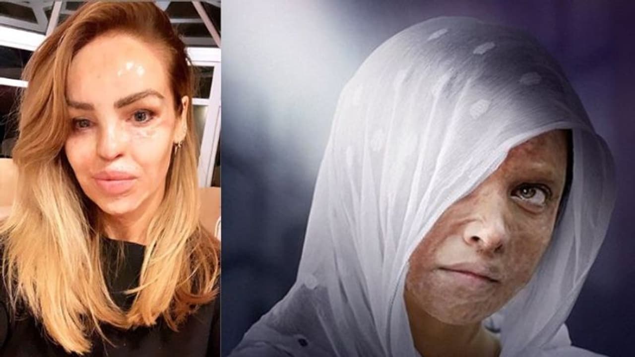 বলিউড ছেড়ে হলিউডে, 'ছপাক' এর ট্রেলারে প্রশংসিত দীপিকা বলিউড ছেড়ে হলিউডে, 'ছপাক' এর ট্রেলারে প্রশংসিত দীপিকা