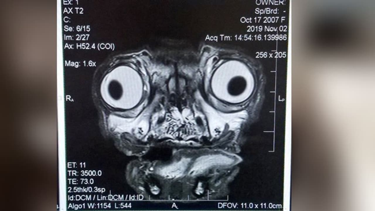 वायरल हुई एक्स रे रिपोर्ट की तस्वीर, देखकर डर गए लोग