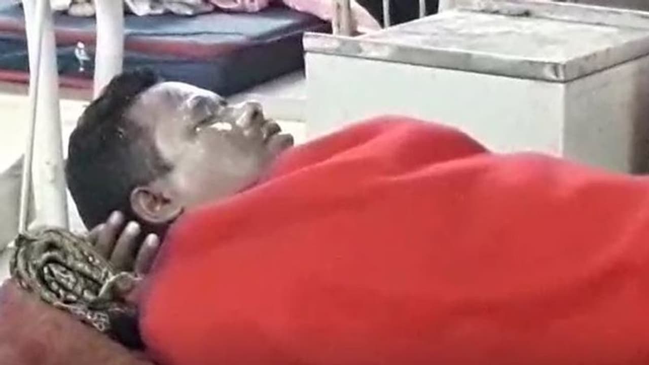 পুলিশকর্মীকে লক্ষ্য করে অ্যাসিড হামলা, চাঞ্চল্য পুরুলিয়ায়