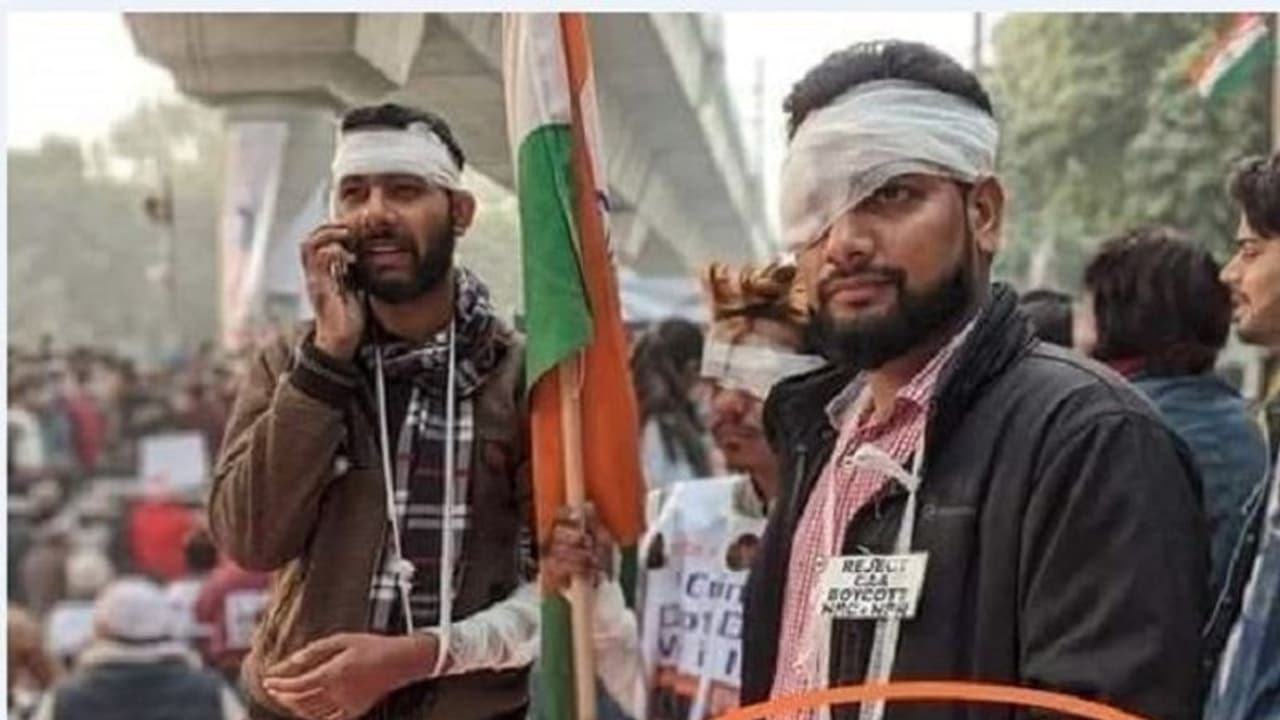 Fact Check: ಗಾಯಗೊಳ್ಳದಿದ್ದರೂ ಬ್ಯಾಂಡೇಜ್ ಸುತ್ತಿಕೊಂಡ್ರಾ CAA ಪ್ರತಿಭಟನಾಕಾರರು? Fact Check: ಗಾಯಗೊಳ್ಳದಿದ್ದರೂ ಬ್ಯಾಂಡೇಜ್ ಸುತ್ತಿಕೊಂಡ್ರಾ CAA ಪ್ರತಿಭಟನಾಕಾರರು?