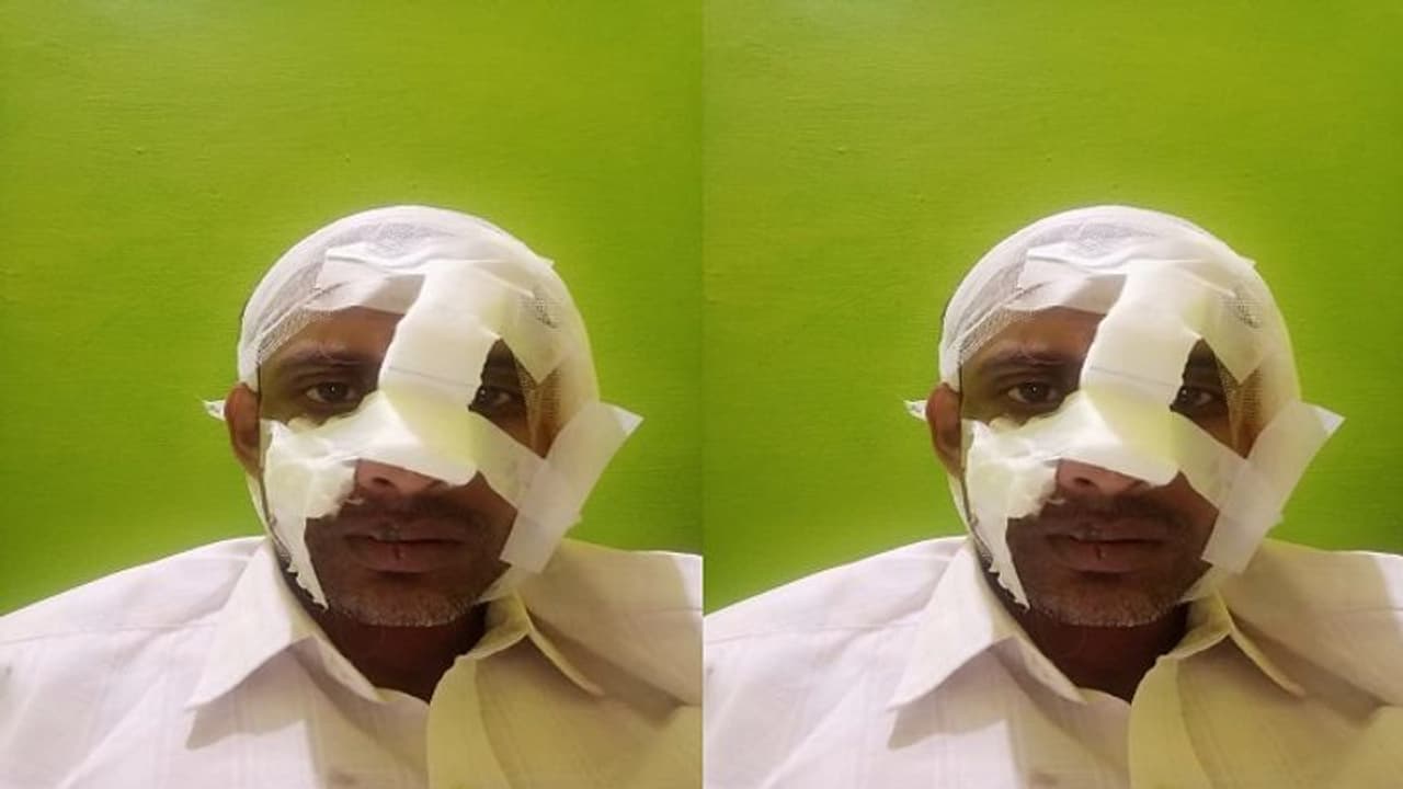 ಬೆಂಗಳೂರು: ಕುಡಿದು ಗಲಾಟೆ ಮಾಡ್ಬೇಡ, ಬುದ್ಧಿ ಹೇಳಿದವರಿಗೆ ಇದೆಂಥಾ ಅವಸ್ಥೆ ಬೆಂಗಳೂರು: ಕುಡಿದು ಗಲಾಟೆ ಮಾಡ್ಬೇಡ, ಬುದ್ಧಿ ಹೇಳಿದವರಿಗೆ ಇದೆಂಥಾ ಅವಸ್ಥೆ