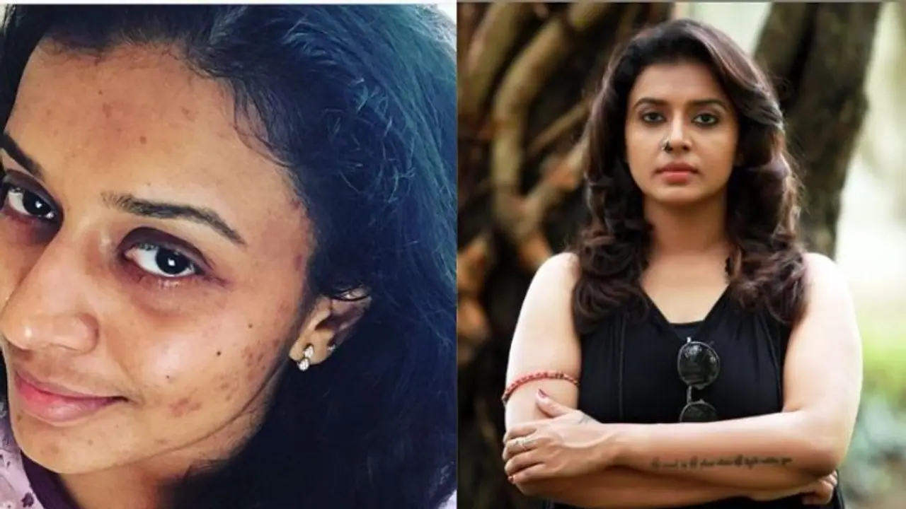 അതിനെ നിങ്ങളെ വേദനിപ്പിക്കാന് അനുവദിക്കാതിരിക്കക; ആത്മവിശ്വാസം പകര്ന്ന് സിത്താരയുടെ കുറിപ്പ് അതിനെ നിങ്ങളെ വേദനിപ്പിക്കാന് അനുവദിക്കാതിരിക്കക; ആത്മവിശ്വാസം പകര്ന്ന് സിത്താരയുടെ കുറിപ്പ്