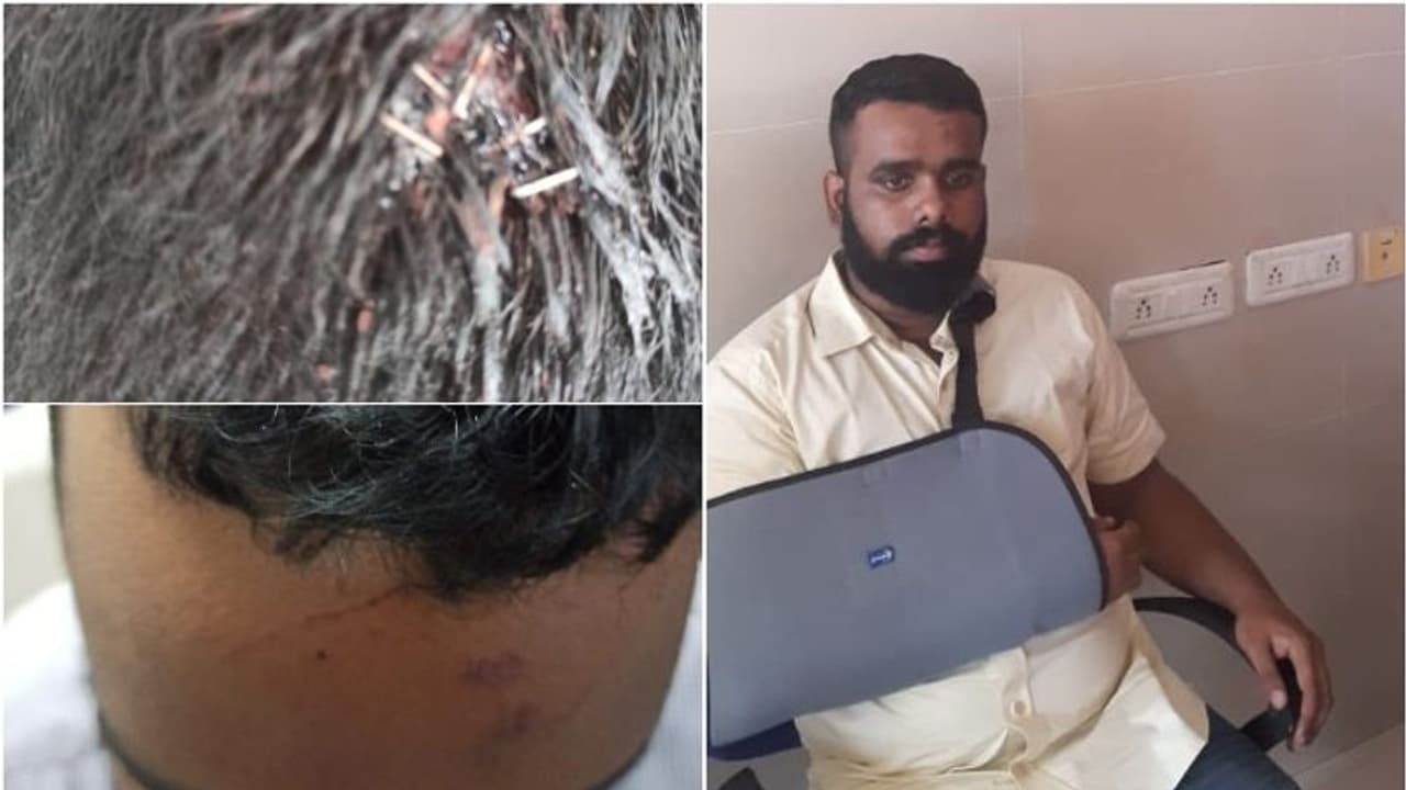 'ഞാന് ശവമായാണ് എത്തിയതെങ്കില് അവര് സന്തോഷിച്ചേനെ'; പ്രചാരണങ്ങള്ക്ക് മറുപടിയുമായി ജെഎന്യു വിദ്യാര്ത്ഥി 'ഞാന് ശവമായാണ് എത്തിയതെങ്കില് അവര് സന്തോഷിച്ചേനെ'; പ്രചാരണങ്ങള്ക്ക് മറുപടിയുമായി ജെഎന്യു വിദ്യാര്ത്ഥി