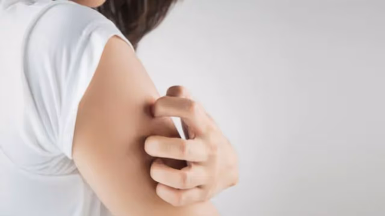 തൊലിപ്പുറത്തെ പാടുകളും ചൊറിച്ചിലും മാറ്റാന്‍ മൂന്ന് വഴികള്‍...