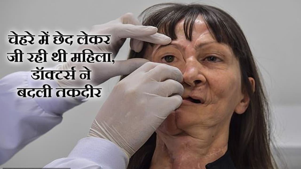 कैंसर से तबाह महिला का पति ने छोड़ा साथ, अपना ही चेहरा देख रो पड़ती थी बहादुर कैंसर से तबाह महिला का पति ने छोड़ा साथ, अपना ही चेहरा देख रो पड़ती थी बहादुर