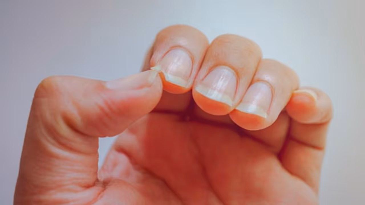 নখ মজবুত করতে ও নখের বৃদ্ধিতে ব্যবহার করুন এই বিশেষ টনিক, জেনে নিন কীভাবে বানাবেন নখ মজবুত করতে ও নখের বৃদ্ধিতে ব্যবহার করুন এই বিশেষ টনিক, জেনে নিন কীভাবে বানাবেন