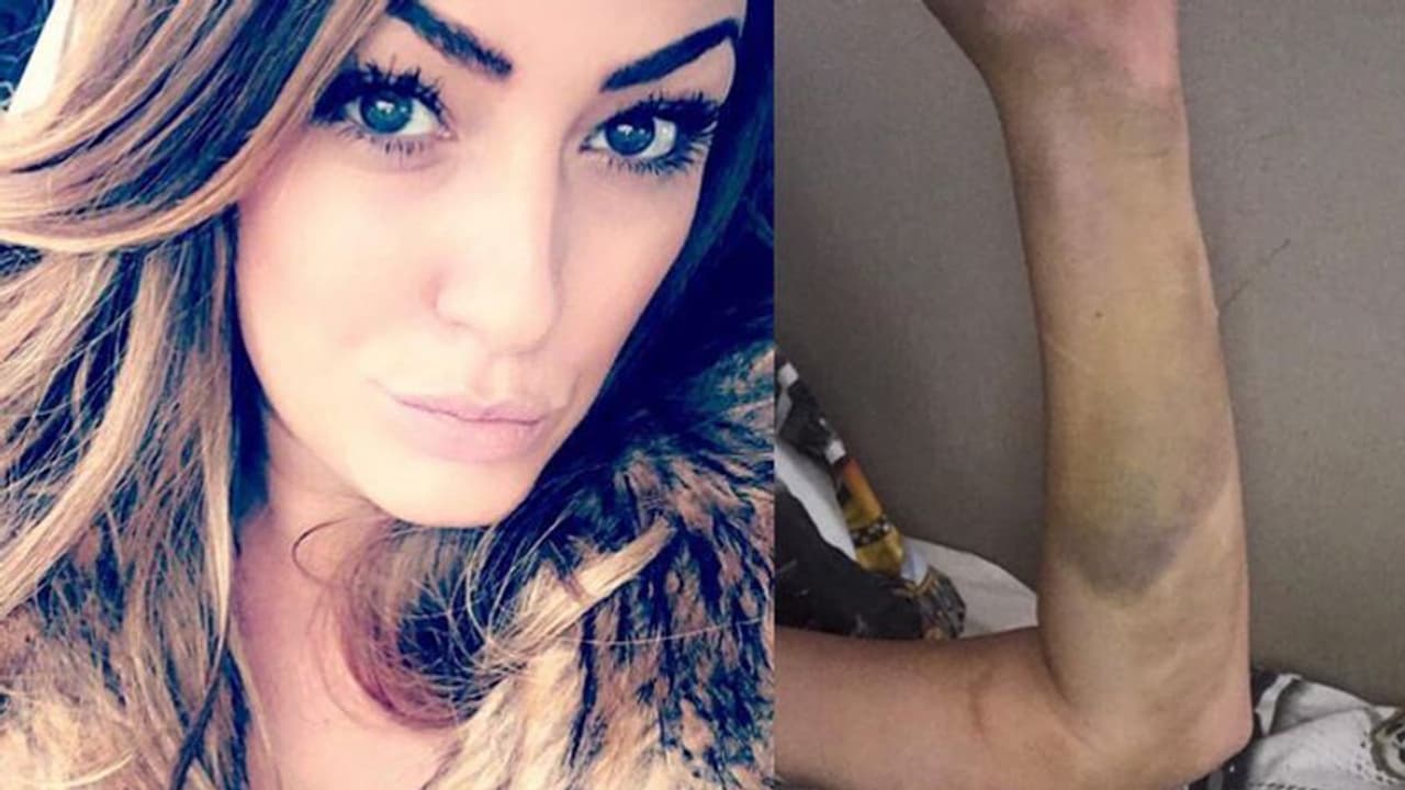 എപ്പോഴും ശ്വാസംമുട്ടലും ക്ഷീണവും, സ്ഥിരമായി ​ഗർഭനിരോധന ​ഗുളിക കഴിച്ച യുവതിയ്ക്ക് സംഭവിച്ചത്....