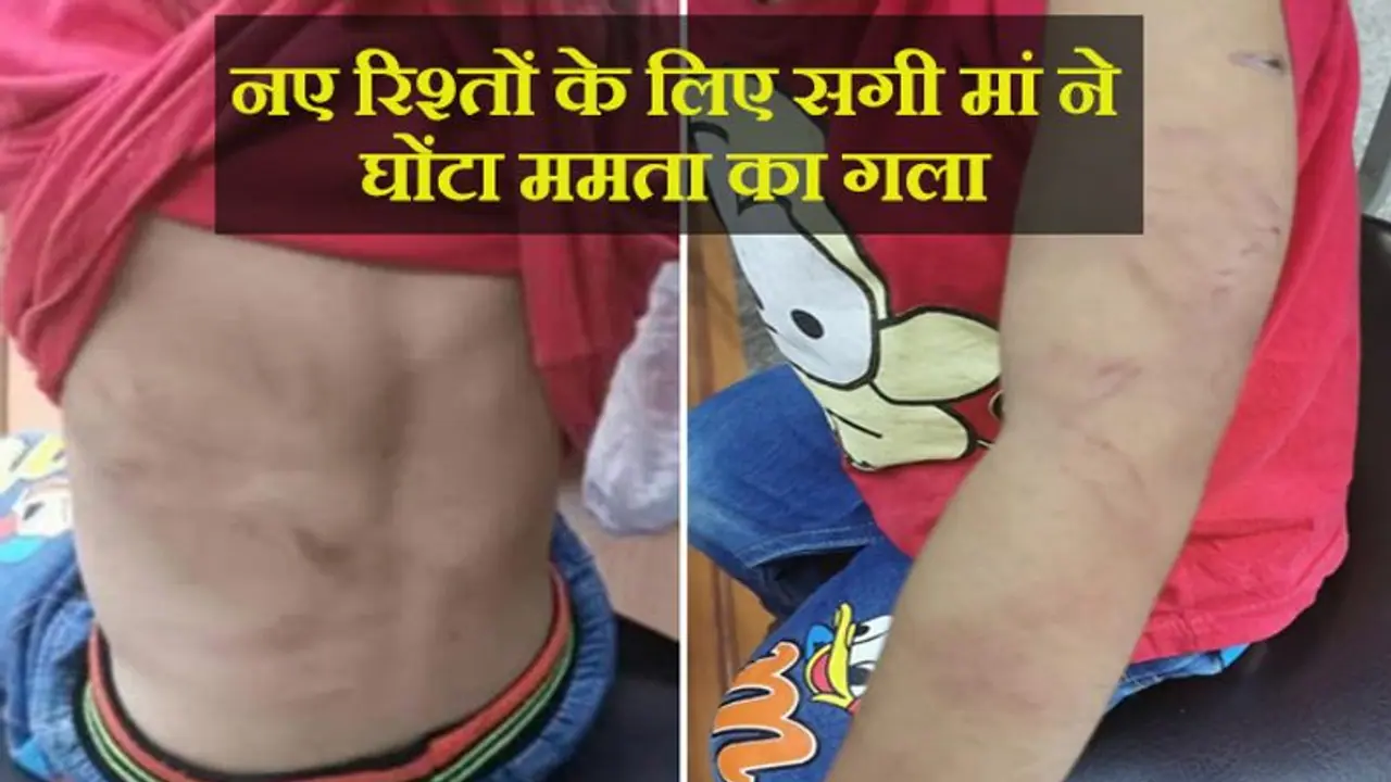 उधेड़ी हुई चमड़ी और गहरे घाव के साथ मिली 2 साल की बच्ची, पोटली की चिट्ठी से खुला खौफनाक राज उधेड़ी हुई चमड़ी और गहरे घाव के साथ मिली 2 साल की बच्ची, पोटली की चिट्ठी से खुला खौफनाक राज