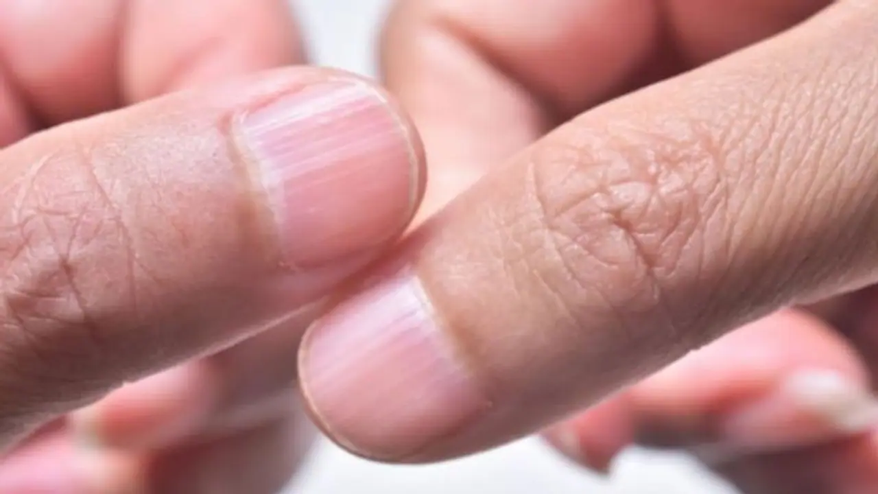 নখের এই সাধারণ পরিবর্তনগুলি জানান দেয় আপনার শারীরিক সমস্যা রয়েছে নখের এই সাধারণ পরিবর্তনগুলি জানান দেয় আপনার শারীরিক সমস্যা রয়েছে