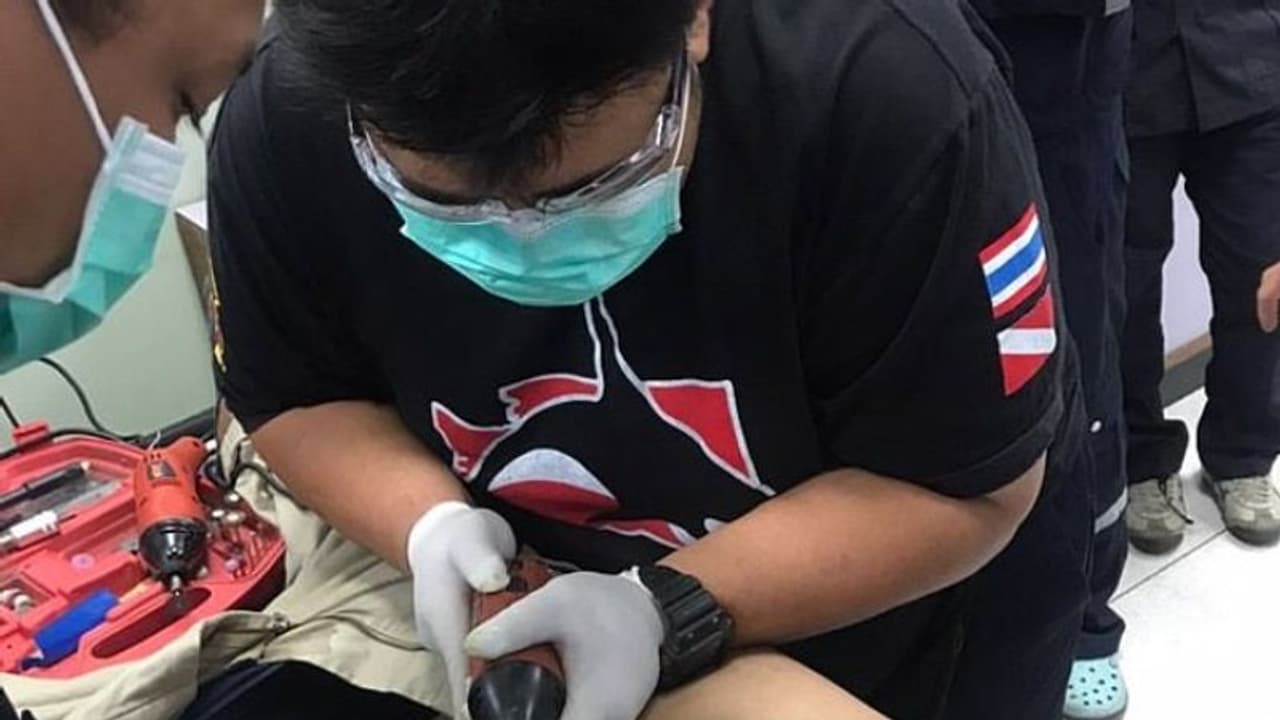 ഇരുമ്പ് പൈപ്പിനുളളില് ലിംഗം കുടുങ്ങി; അഞ്ചാം ദിവസം അഴുകാന് തുടങ്ങി; 21കാരന് പിന്നീട് ചെയ്തത്... ഇരുമ്പ് പൈപ്പിനുളളില് ലിംഗം കുടുങ്ങി; അഞ്ചാം ദിവസം അഴുകാന് തുടങ്ങി; 21കാരന് പിന്നീട് ചെയ്തത്...