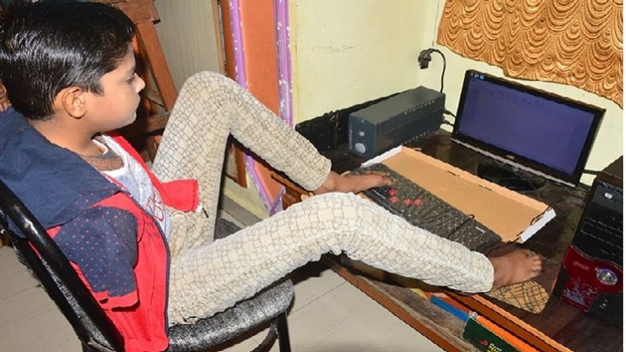 मां बाप ने मासूम बेटे का कटवा दिया था इस तरह दोनों हाथ, आज हर कोई करता है जज्बे को सलाम मां बाप ने मासूम बेटे का कटवा दिया था इस तरह दोनों हाथ, आज हर कोई करता है जज्बे को सलाम