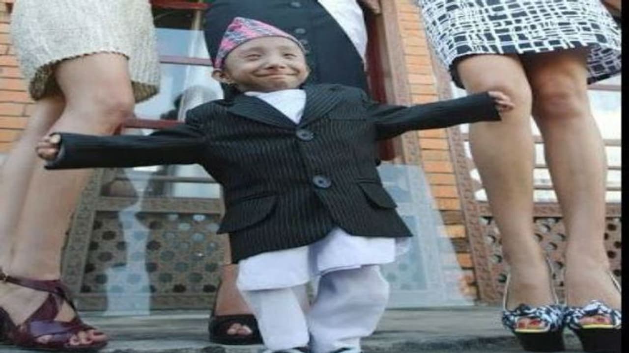 মাত্র ২৭ এই থেমে গেল জীবন, চলে গেলেন পৃথিবীর ক্ষুদ্রতম ব্যক্তি মাত্র ২৭ এই থেমে গেল জীবন, চলে গেলেন পৃথিবীর ক্ষুদ্রতম ব্যক্তি