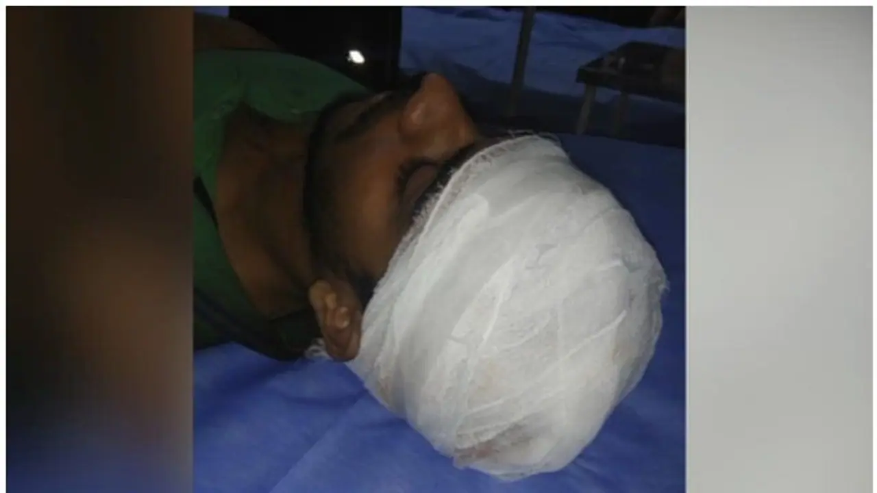 കുസാറ്റില് എസ്എഫ്ഐ നേതാക്കള് വിദ്യാര്ത്ഥിയെ കാറിടിച്ച് വീഴ്ത്തി ആക്രമിച്ചെന്ന് പരാതി; വിദ്യാര്ത്ഥി പ്രതിഷേധം കുസാറ്റില് എസ്എഫ്ഐ നേതാക്കള് വിദ്യാര്ത്ഥിയെ കാറിടിച്ച് വീഴ്ത്തി ആക്രമിച്ചെന്ന് പരാതി; വിദ്യാര്ത്ഥി പ്രതിഷേധം