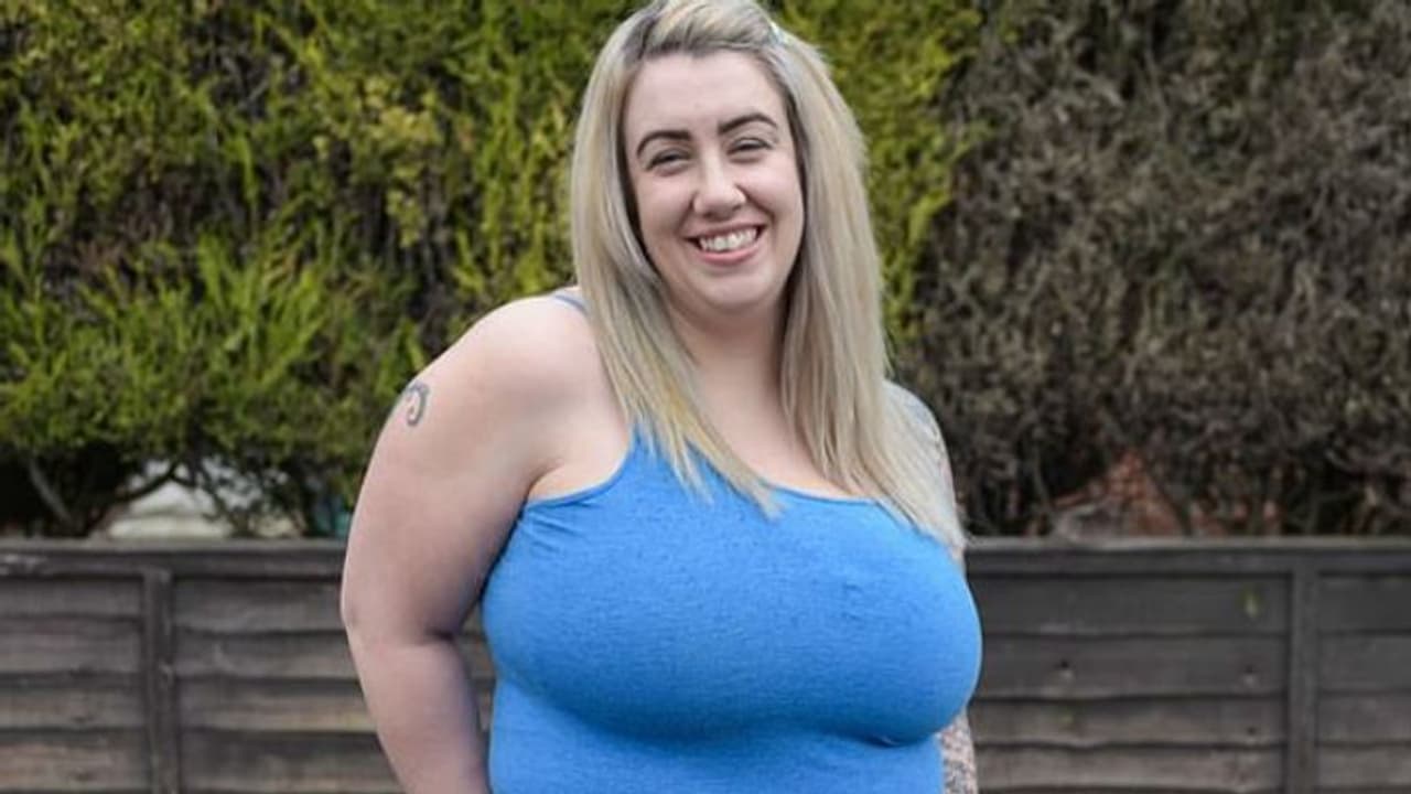 സ്തനങ്ങളുടെ അസാമാന്യ വലിപ്പം മൂലം വേദന; ഒടുവില്‍ ശസ്ത്രക്രിയയ്ക്കായി പിരിവ് ചോദിച്ച് യുവതി