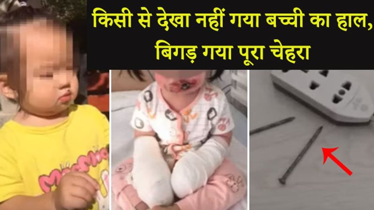 स्विचबोर्ड के पास पहुंच बच्ची ने अंदर घुसा दी लोहे की कील, देखा नहीं गया मासूम का चेहरा स्विचबोर्ड के पास पहुंच बच्ची ने अंदर घुसा दी लोहे की कील, देखा नहीं गया मासूम का चेहरा