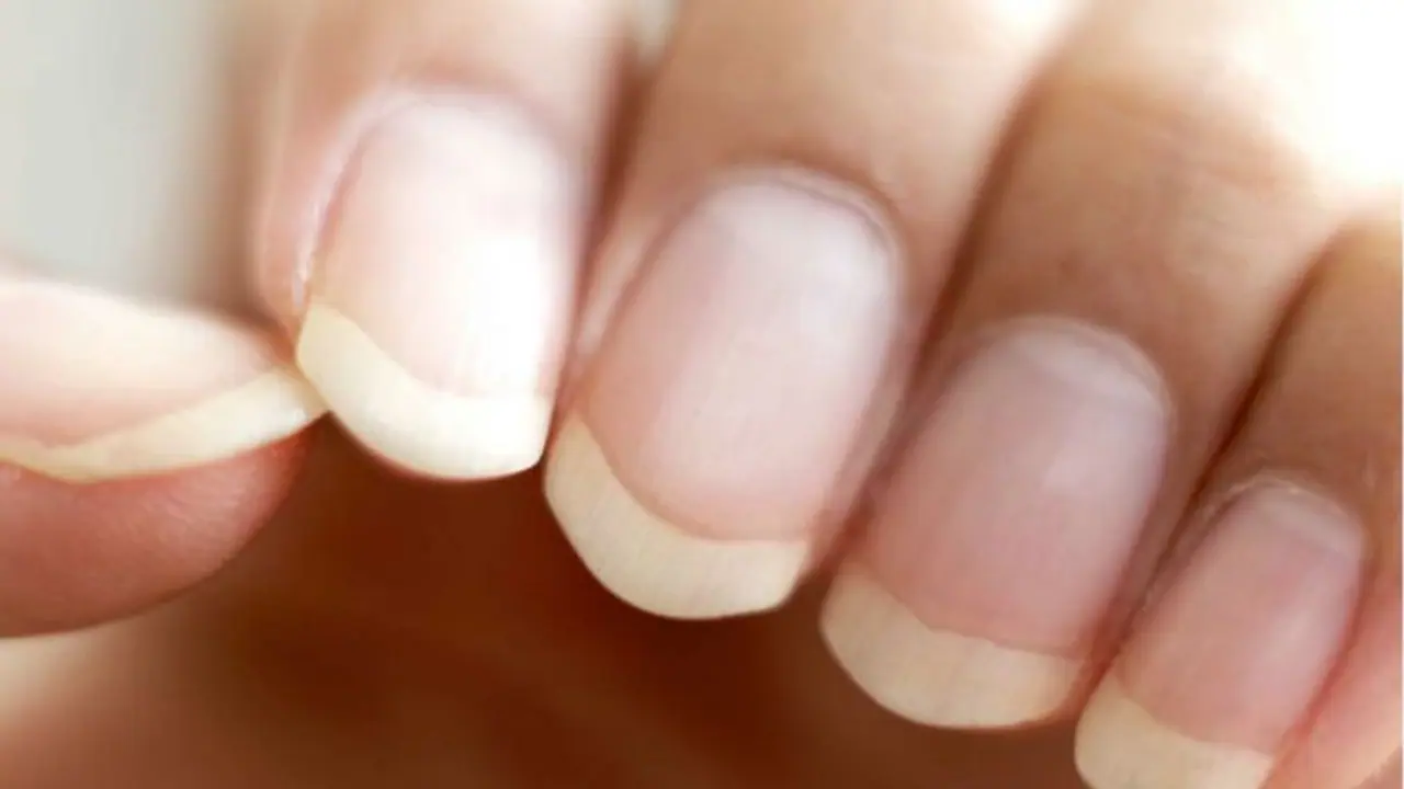 Vitamins For Healthy Nails : നഖങ്ങളുടെ ആരോ​ഗ്യത്തിന് വേണം ഈ പോഷകങ്ങൾ