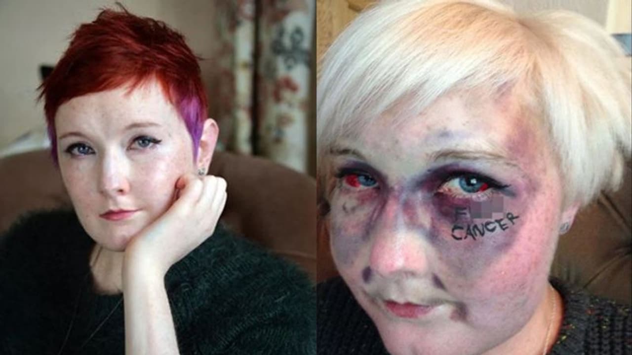 മരണത്തെ പേടിച്ചിരുന്നില്ല... യുവതി രക്താർബുദവുമായി ജീവിച്ചത് 13 വർഷം; 28ാം വയസിൽ മരണത്തിന് കീഴടങ്ങി മരണത്തെ പേടിച്ചിരുന്നില്ല... യുവതി രക്താർബുദവുമായി ജീവിച്ചത് 13 വർഷം; 28ാം വയസിൽ മരണത്തിന് കീഴടങ്ങി