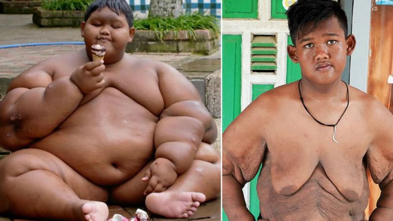 ആര്യ ഇനി ലോകത്തെ ഏറ്റവും വണ്ണമുള്ള കുട്ടിയല്ല; ഇത് അമ്പരപ്പിക്കുന്ന മാറ്റം... ആര്യ ഇനി ലോകത്തെ ഏറ്റവും വണ്ണമുള്ള കുട്ടിയല്ല; ഇത് അമ്പരപ്പിക്കുന്ന മാറ്റം...