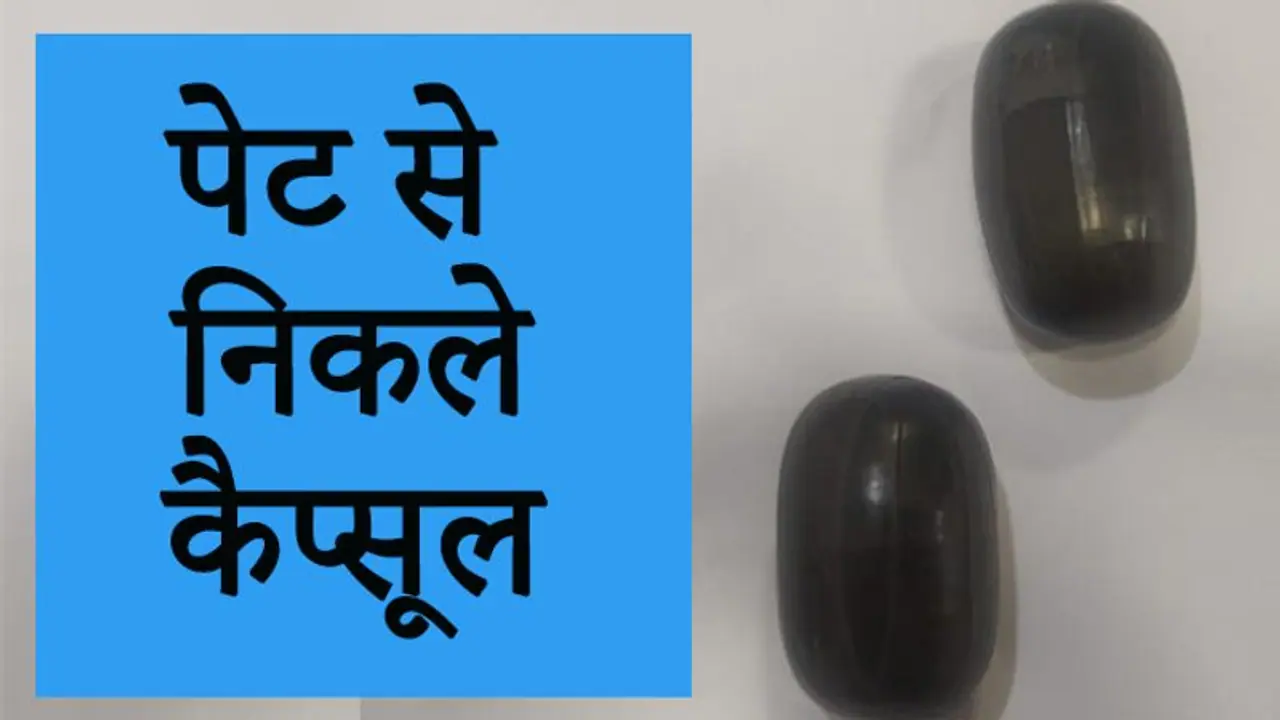 पेट में दिख रही थी कुछ अजीब सी हलचल, चेक किया गया, तो उड़ गए होश पेट में दिख रही थी कुछ अजीब सी हलचल, चेक किया गया, तो उड़ गए होश