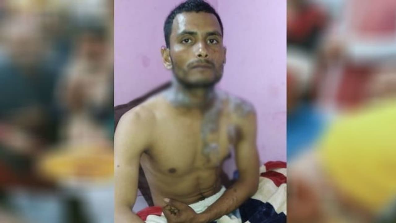 इस वजह से एक लड़की ने युवक पर फेंका तेजाब, गंभीर हालत में अस्पताल में भर्ती इस वजह से एक लड़की ने युवक पर फेंका तेजाब, गंभीर हालत में अस्पताल में भर्ती