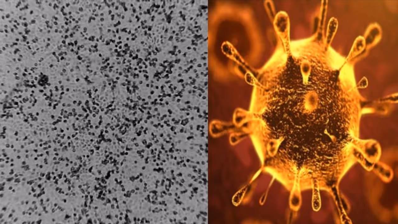 കൊറോണ വൈറസിനെ ലാബില് വളര്ത്തിയെടുത്ത് ഓസ്ട്രേലിയ; പ്രതിരോധ മരുന്ന് നിര്മ്മാണത്തില് നിര്ണായക ചുവട് കൊറോണ വൈറസിനെ ലാബില് വളര്ത്തിയെടുത്ത് ഓസ്ട്രേലിയ; പ്രതിരോധ മരുന്ന് നിര്മ്മാണത്തില് നിര്ണായക ചുവട്