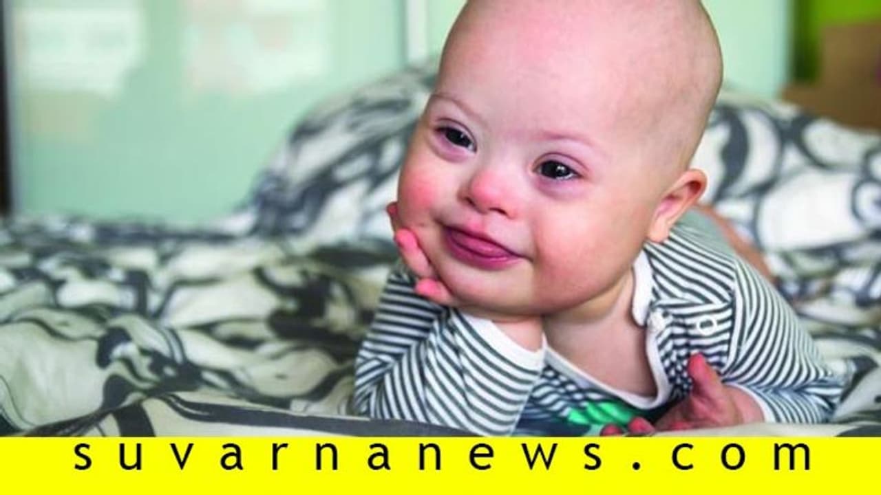 ಡೌನ್ ಸಿಂಡ್ರೋಮ್ ಮಗು ತೋರಿಸೋ ಪ್ರೀತಿ ಮುಂದೆ ಬೇರೇನೂ ಇಲ್ಲ! ಡೌನ್ ಸಿಂಡ್ರೋಮ್ ಮಗು ತೋರಿಸೋ ಪ್ರೀತಿ ಮುಂದೆ ಬೇರೇನೂ ಇಲ್ಲ!