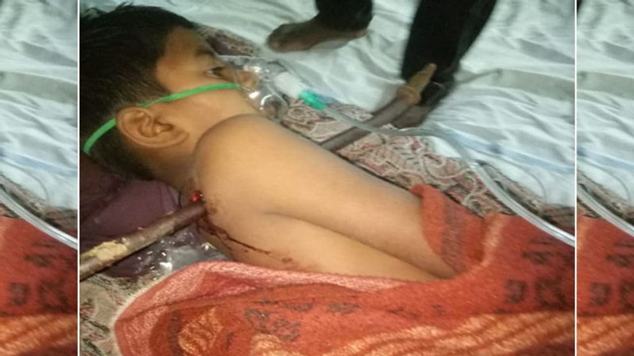 शॉकिंग तस्वीर: 9 साल के बच्चे के सीने से आर पार हुई 4 फीट की रॉड, पर उसने नहीं छोड़ी हिम्मत