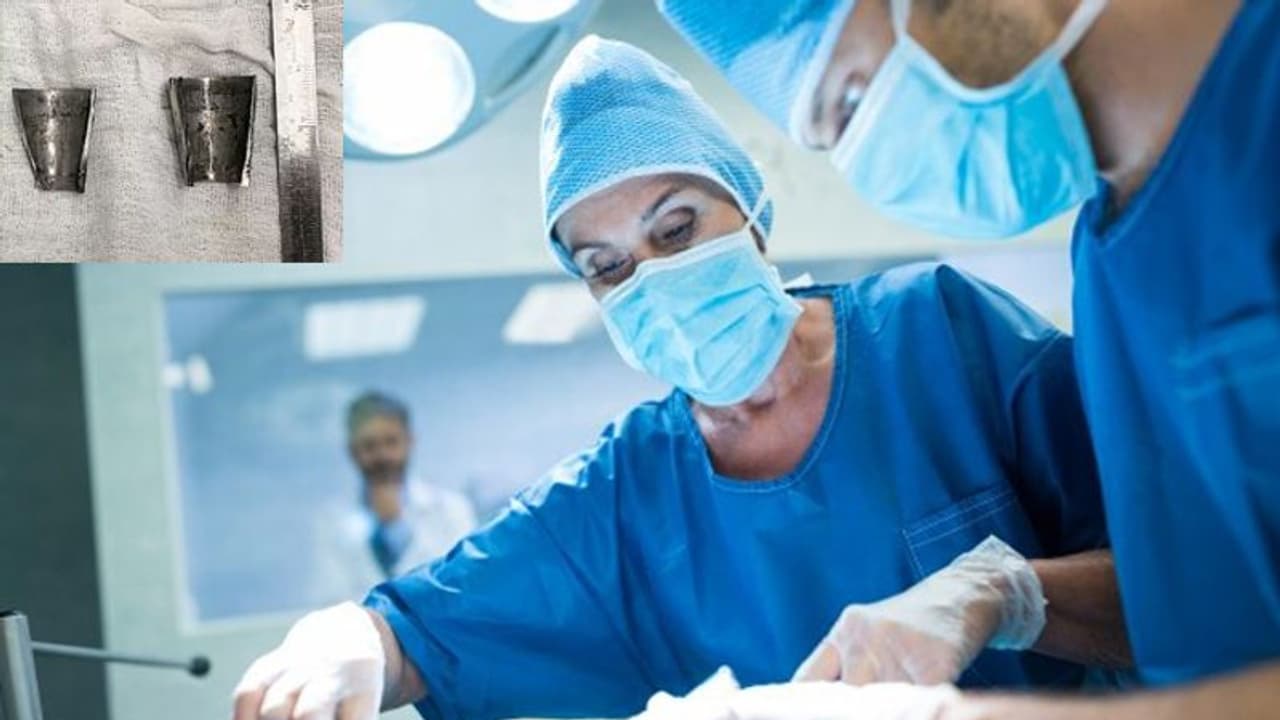 ലിംഗത്തിൽ കുടുങ്ങിയ ഇരുമ്പുവളയം ശസ്ത്രക്രിയയിലൂടെ പുറത്തെടുത്തു ലിംഗത്തിൽ കുടുങ്ങിയ ഇരുമ്പുവളയം ശസ്ത്രക്രിയയിലൂടെ പുറത്തെടുത്തു