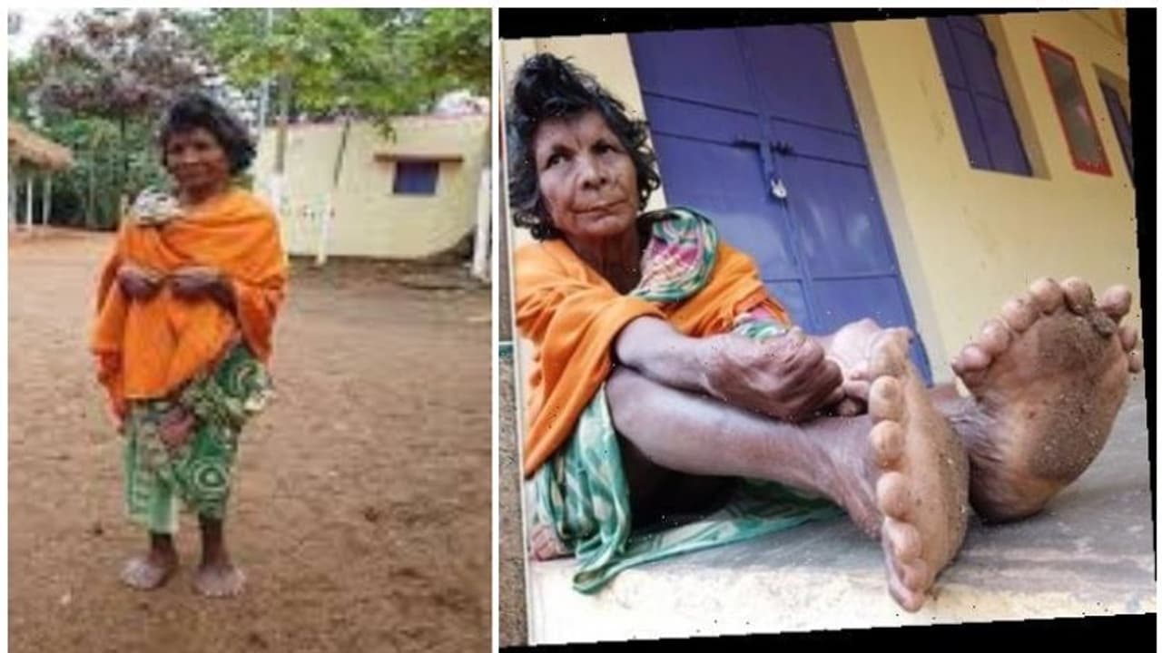 சூனியக்காரி என அழைத்ததால் மன வேதனை பட்டவர் இன்று கின்னஸ் சாதனை...!