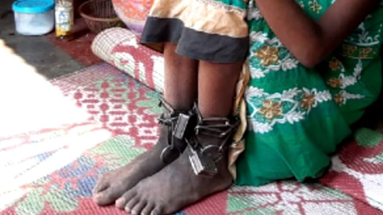 শিকলে বাঁধা ১২ বছরের মেয়ে, আজব চিত্র বর্ধমানে শিকলে বাঁধা ১২ বছরের মেয়ে, আজব চিত্র বর্ধমানে