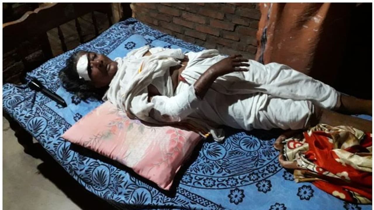 തനിച്ച് താമസിക്കുന്ന വയോധികയ്ക്ക് തെരുവുനായയുടെ ആക്രമണത്തില് ഗുരുതര പരിക്ക് തനിച്ച് താമസിക്കുന്ന വയോധികയ്ക്ക് തെരുവുനായയുടെ ആക്രമണത്തില് ഗുരുതര പരിക്ക്