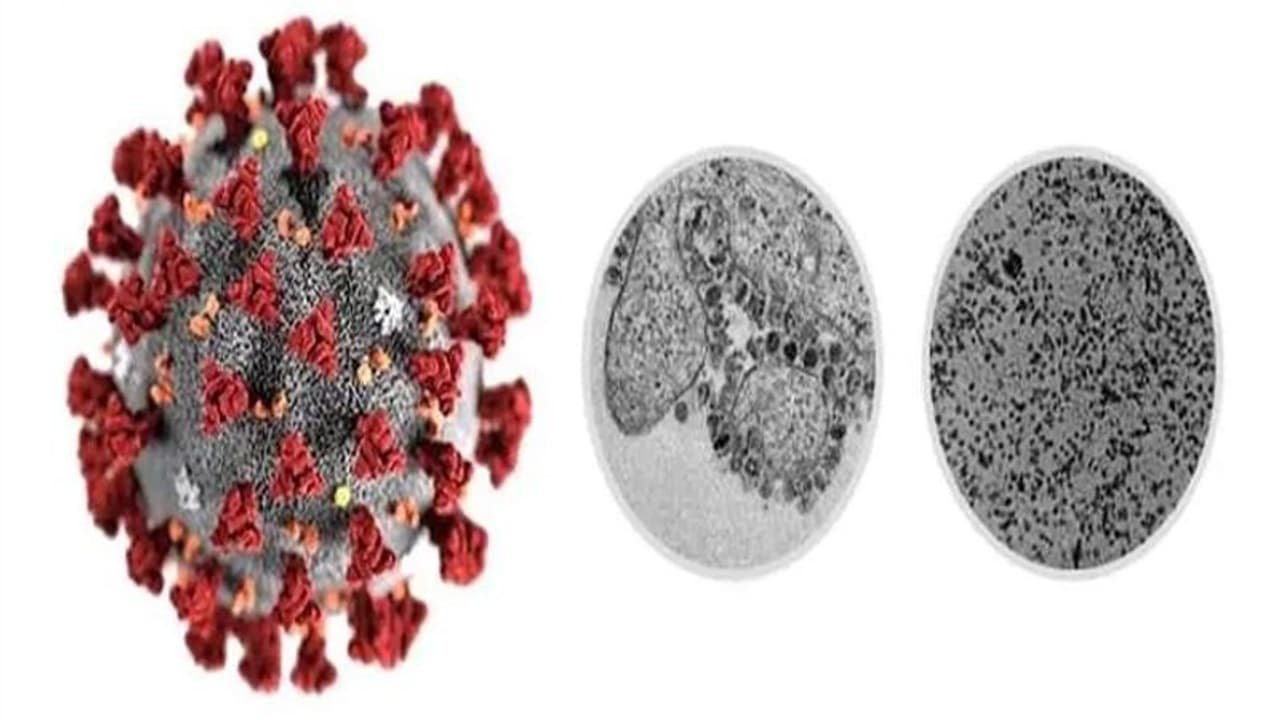 കാസര്കോട്ട് കൊറോണ വൈറസ് ബാധ സംശയത്തില് ഒരാളെ കൂടി ആശുപത്രിയിലേക്ക് മാറ്റി കാസര്കോട്ട് കൊറോണ വൈറസ് ബാധ സംശയത്തില് ഒരാളെ കൂടി ആശുപത്രിയിലേക്ക് മാറ്റി