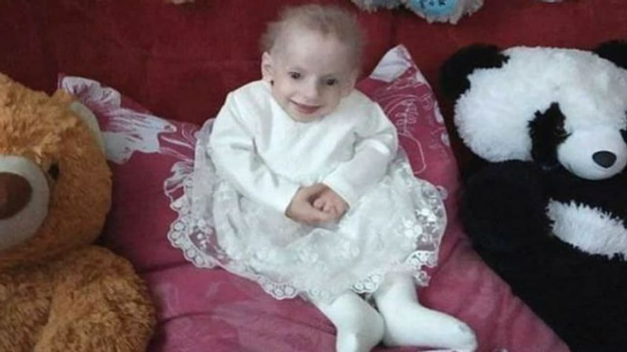 എട്ടാം വയസില് വൃദ്ധയായി, ഒടുവില്‍ മരണം; ഇത് അപൂര്‍വ്വങ്ങളില്‍ അപൂര്‍വ്വമായ രോഗം