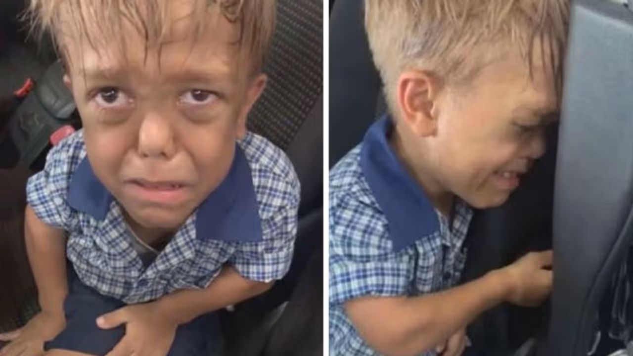 ഉയരക്കുറവിന്റെ പേരില്‍ കളിയാക്കപ്പെട്ട ബാലന്‍; എന്താണ് 'ഡ്വാര്‍ഫിസം'