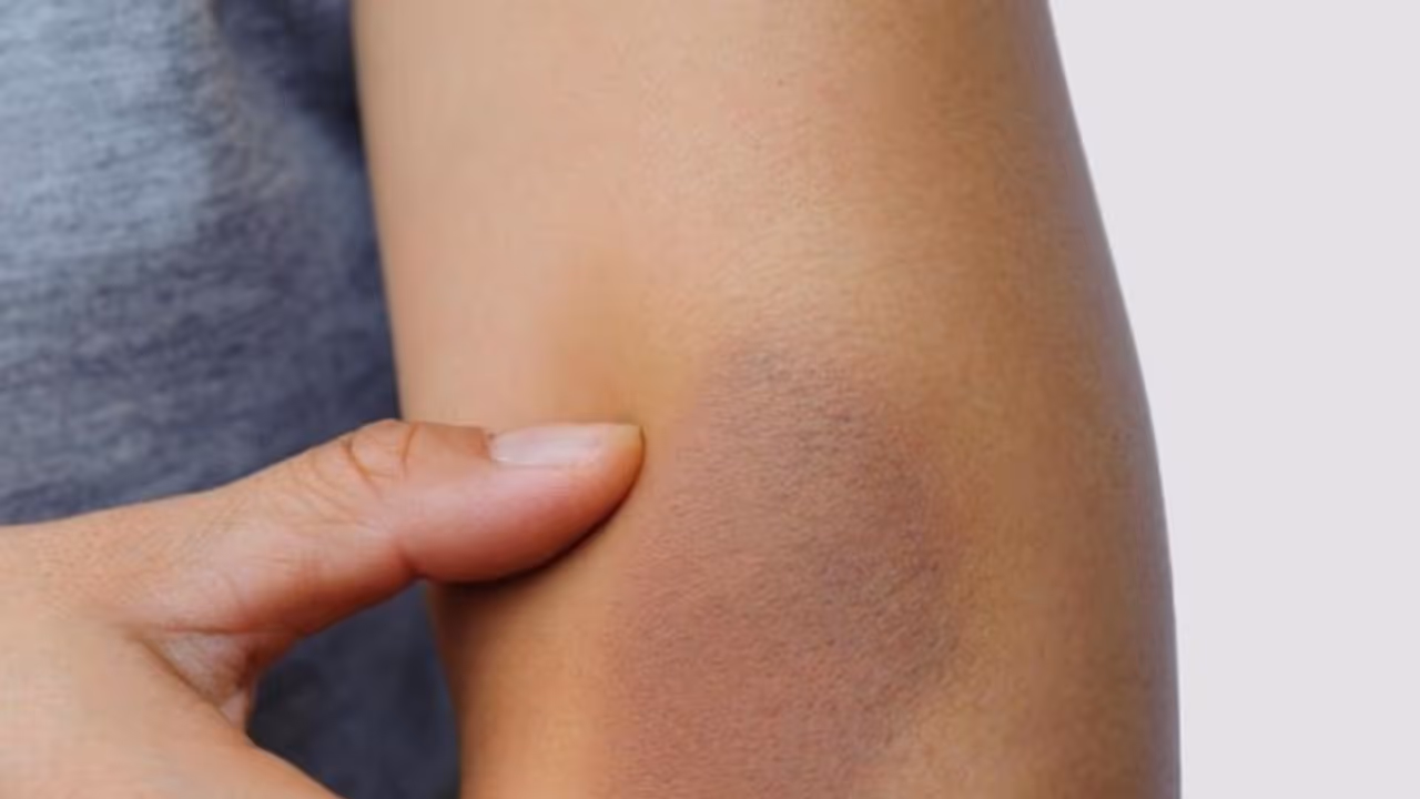 കൈമുട്ടിലെ കറുപ്പ് നിറം മാറ്റാന് ചെയ്യേണ്ടത്... കൈമുട്ടിലെ കറുപ്പ് നിറം മാറ്റാന് ചെയ്യേണ്ടത്...