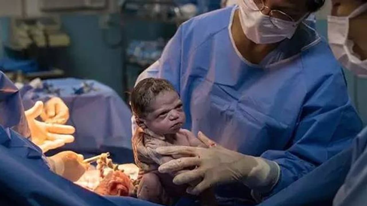 അമ്മയുടെ വയറ്റിൽ നിന്ന് എന്തിനാ എന്നെ പുറത്തെടുത്തേ; വൈറലായി ചിത്രം അമ്മയുടെ വയറ്റിൽ നിന്ന് എന്തിനാ എന്നെ പുറത്തെടുത്തേ; വൈറലായി ചിത്രം