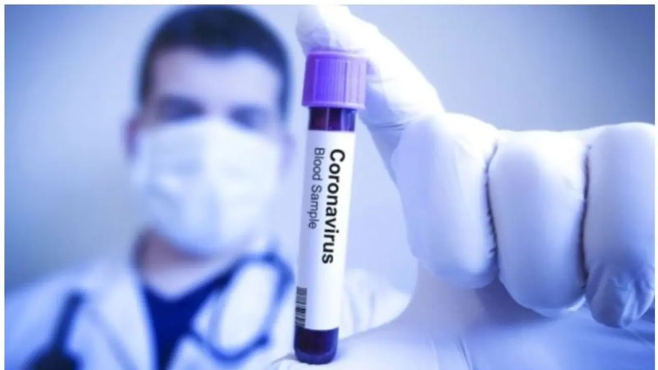 ಕೊರೋನಾ ತಗುಲಿಸಿಕೊಂಡರೆ, ಈ ಕಂಪನಿ ಕೊಡುತ್ತೆ ದೊಡ್ಡ ಮೊತ್ತ!