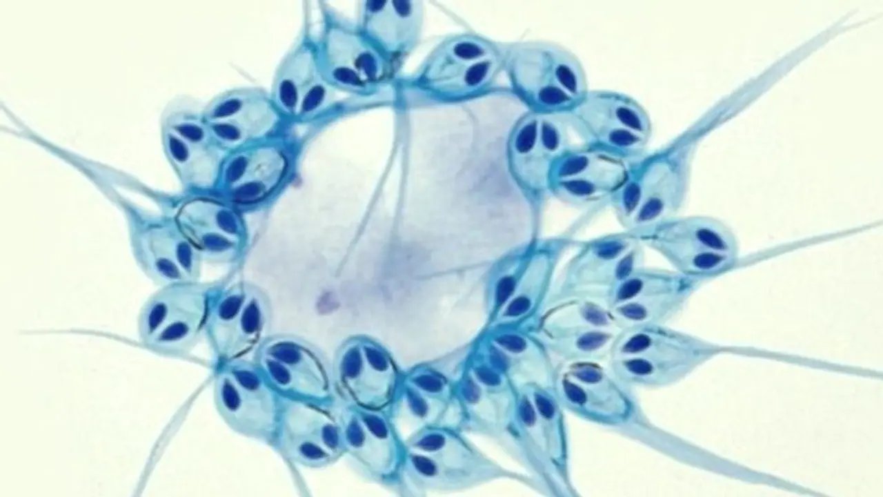 অক্সিজেন ছাড়াই বাঁচে এই প্রাণীরা, নতুন খোঁজ বিজ্ঞানীদের