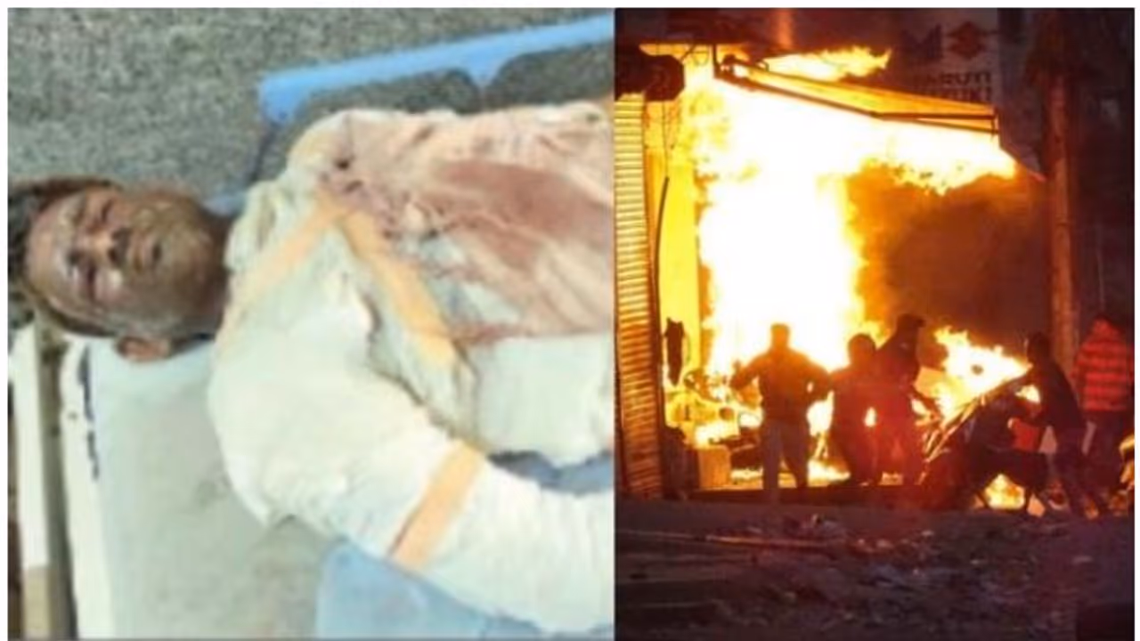 അയല്ക്കാരായ മുസ്ലീങ്ങളെ രക്ഷിച്ചു; പൊള്ളലേറ്റ പ്രേംകാന്ത് ജീവനുമായി മല്ലിടുന്നു അയല്ക്കാരായ മുസ്ലീങ്ങളെ രക്ഷിച്ചു; പൊള്ളലേറ്റ പ്രേംകാന്ത് ജീവനുമായി മല്ലിടുന്നു