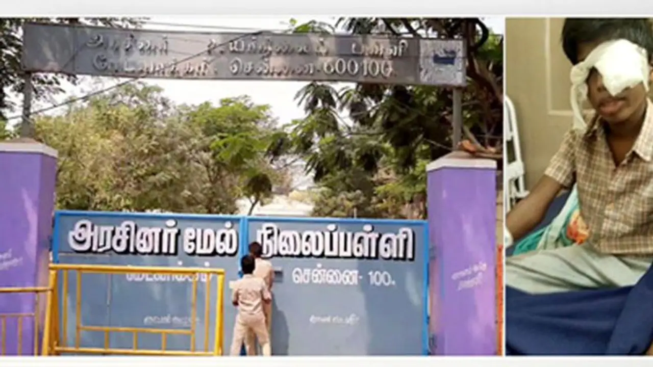 இரும்பு ஸ்கேலால் அடித்த ஆசிரியை... பள்ளி மாணவனுக்கு கண்பார்வை பறிபோனதால் அதிர்ச்சி..! இரும்பு ஸ்கேலால் அடித்த ஆசிரியை... பள்ளி மாணவனுக்கு கண்பார்வை பறிபோனதால் அதிர்ச்சி..!