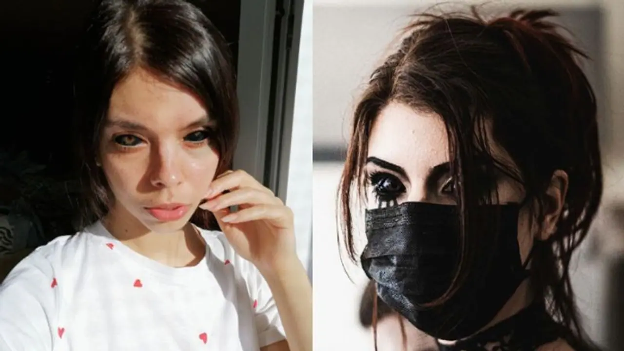 চোখের ভিতরে ট্যাটু, মারাত্মক যন্ত্রণায় শেষমেশ ভয়াবহ পরিণতি সুপার মডেলের চোখের ভিতরে ট্যাটু, মারাত্মক যন্ত্রণায় শেষমেশ ভয়াবহ পরিণতি সুপার মডেলের